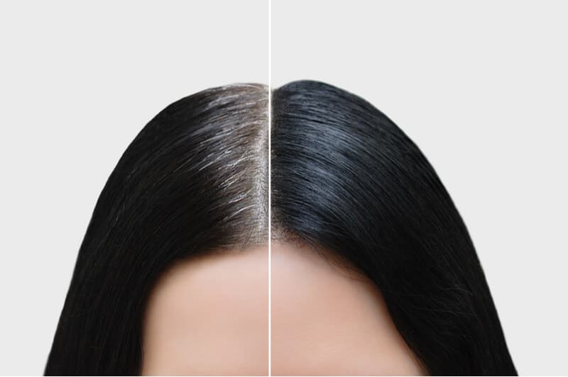 looking for the best scalp treatment